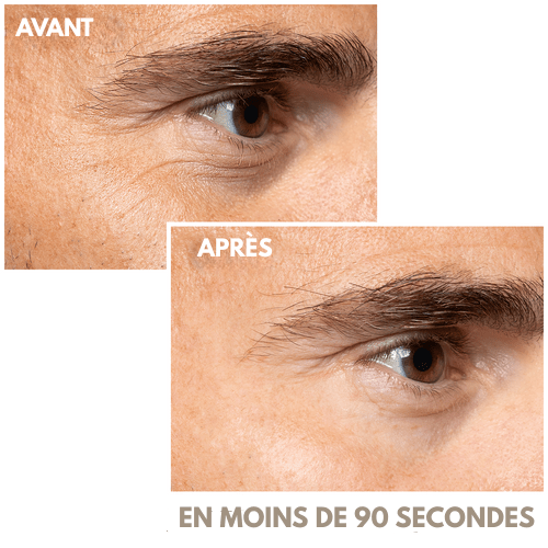 Crème lifting instantanée pour les yeux - ROYAL GROOMING