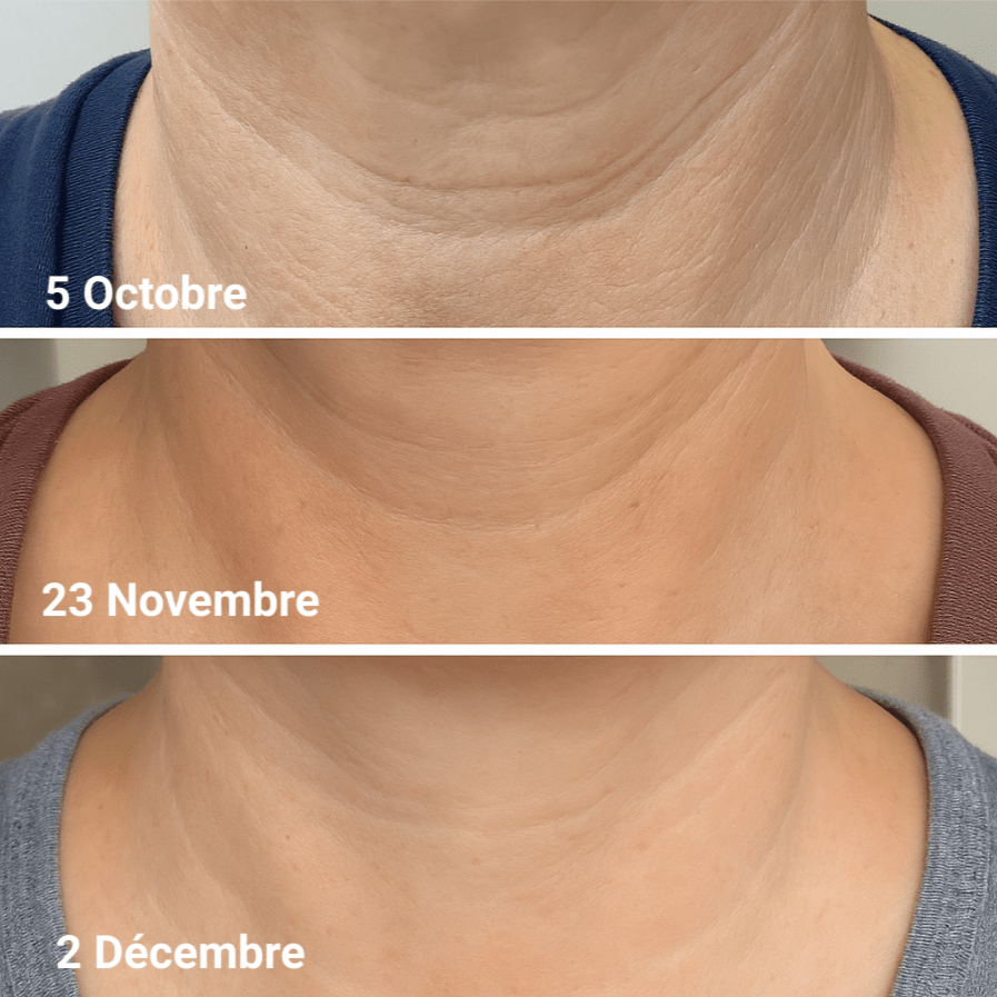 Crème Liftante Cou et Décolleté - ROYAL GROOMING
