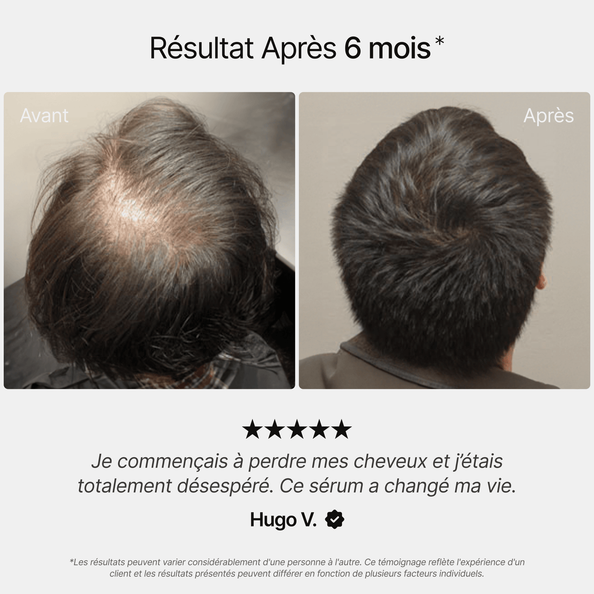 Sérum de Romarin™ - ROYAL GROOMING
